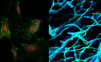 Stem cells (left) were used to create new blood vessels (right).